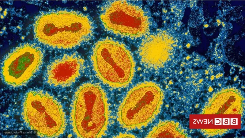 Por que alguns sobrenomes acabam desaparecendo